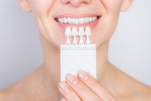 color matching teeth for veneers